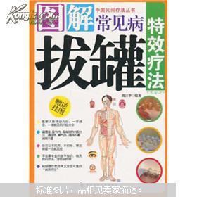 拔罐療法基礎(chǔ)知識(shí)